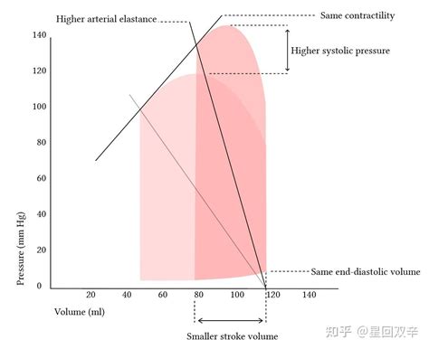 lv 银包推介.